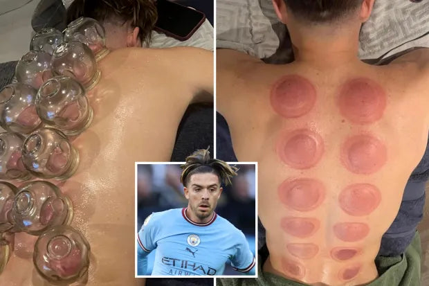 Elite Performance Electric Cupping Massager – Deep Tissue Recovery & Muscle Relief for Soccer Players & Athletes | 6/12 Levels Gua Sha Therapy